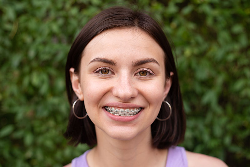 Young girl smiling with metal dental braces on teeth