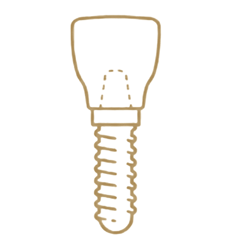 single dental implant