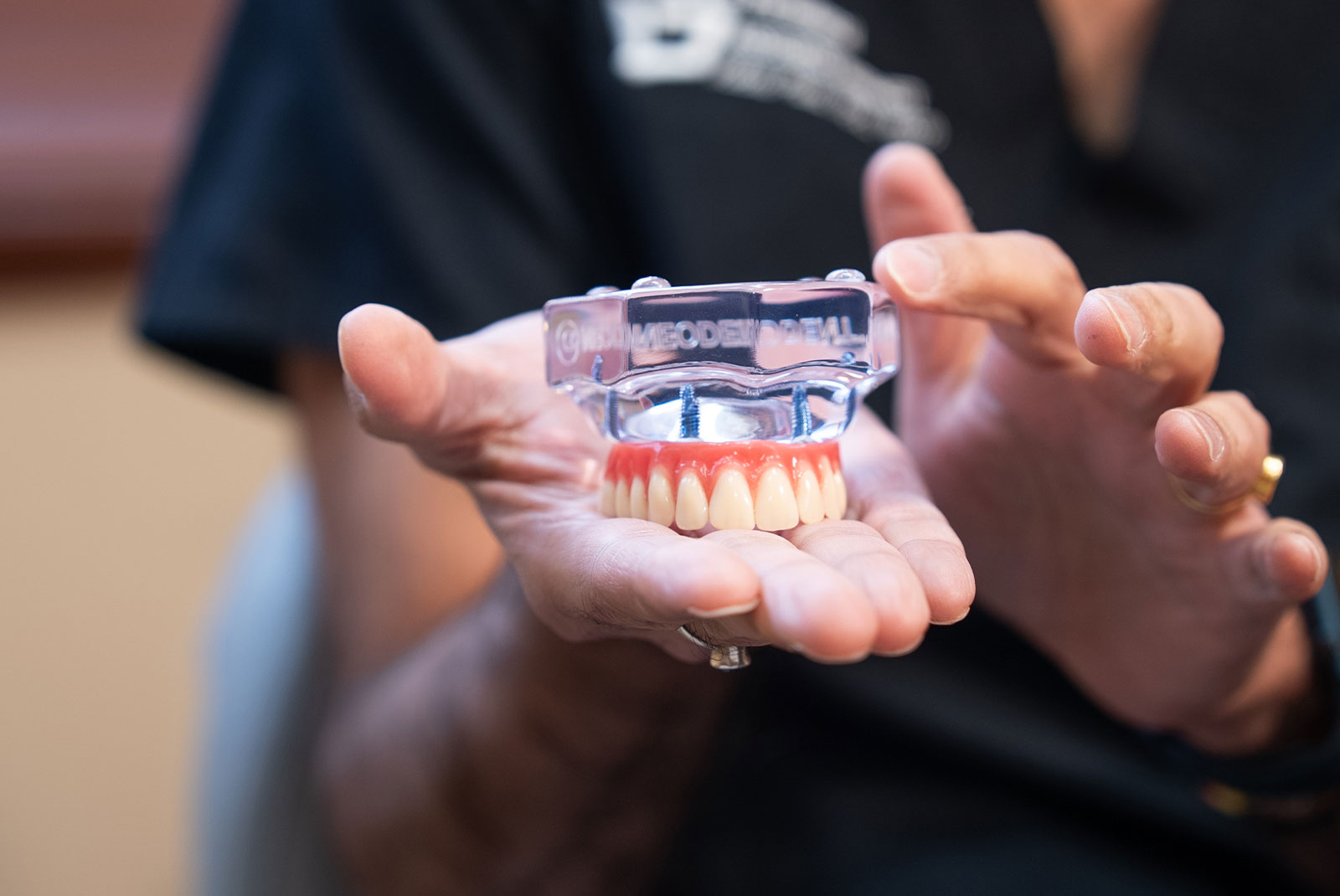 close up of dental full arch model within the dental center