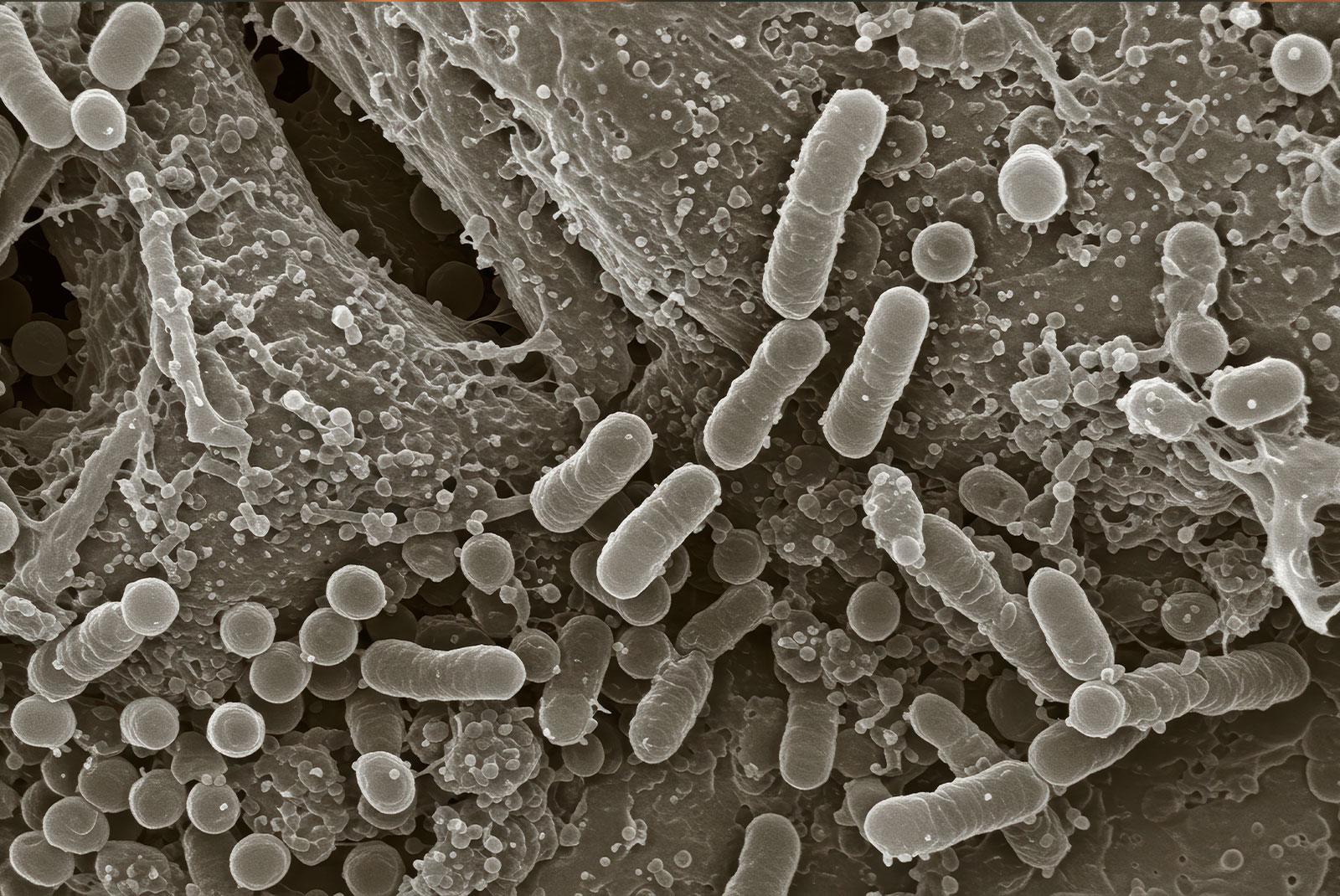 close up of microscopic pathology