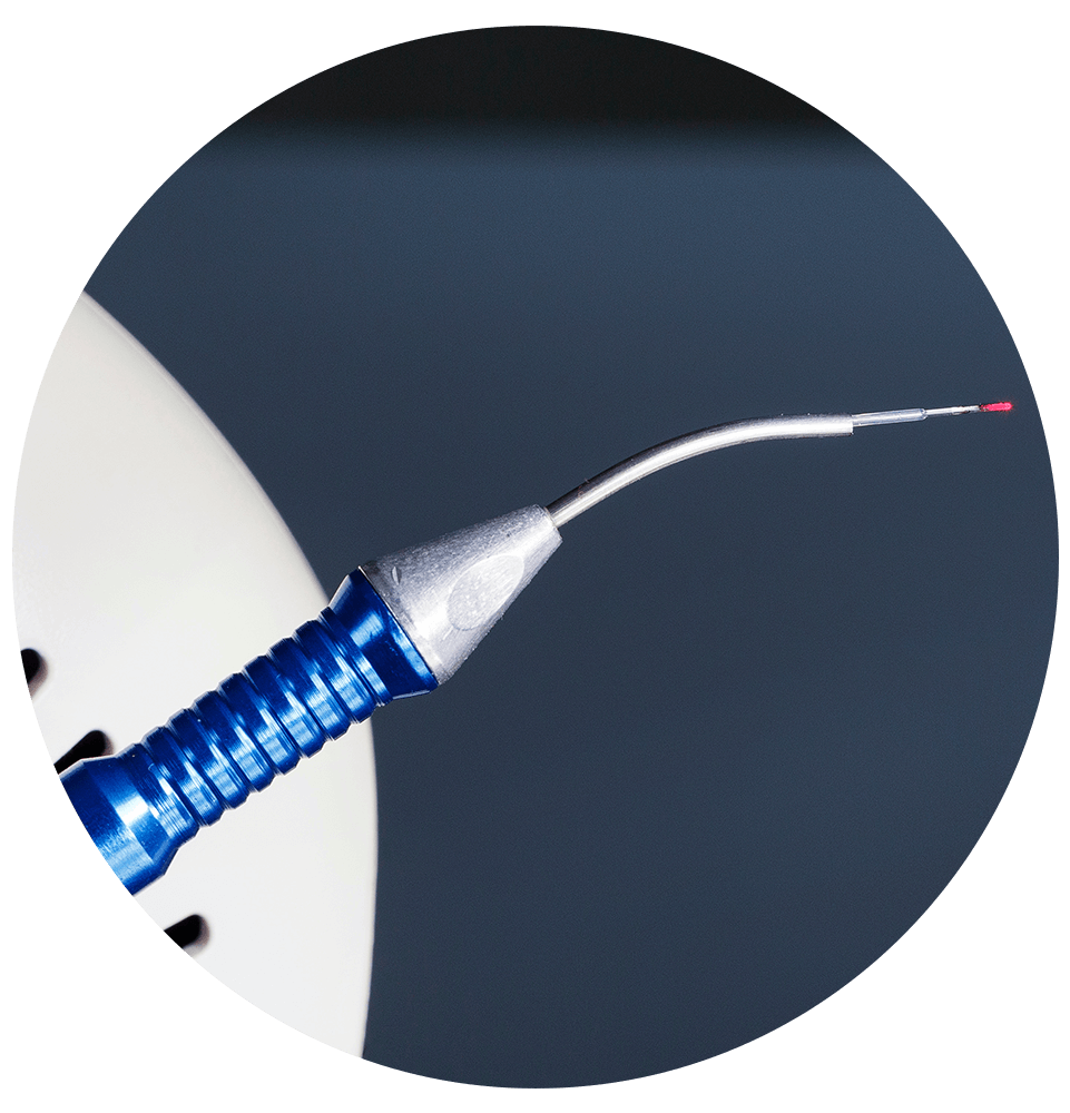 close up of laser device for perio laser
